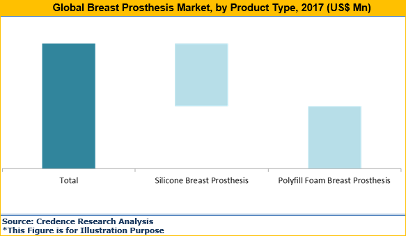 Breast Prosthesis Market