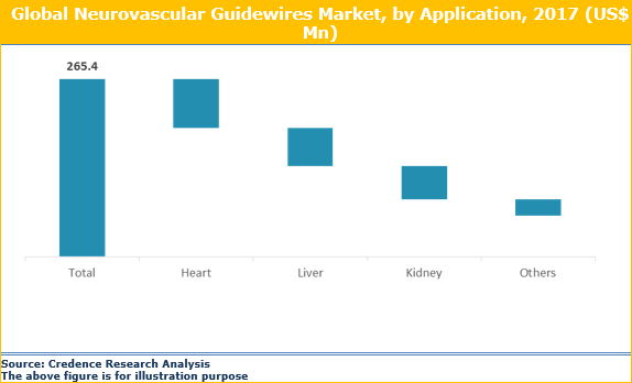 Neurovascular Guidewires Market